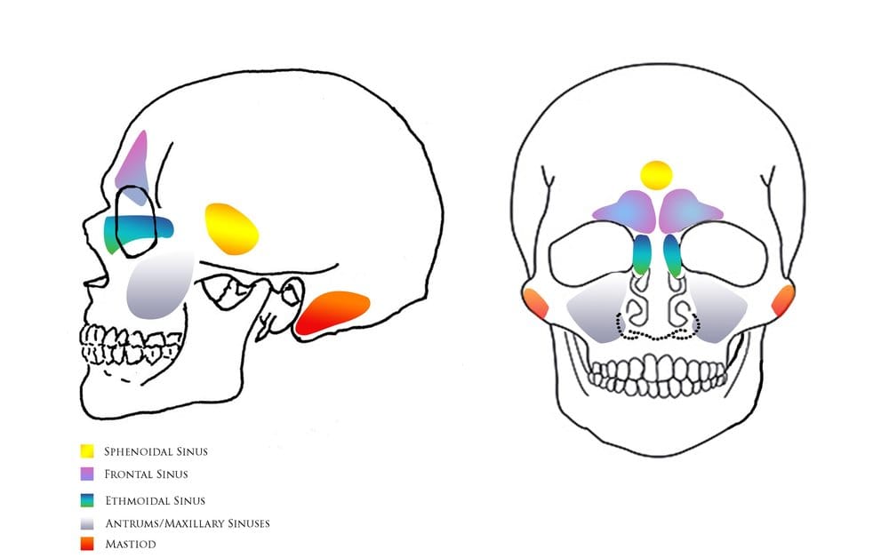 6 Sinus Headaches Graphic